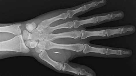 man uses rfid chip europe|rfid chip implants for pets.